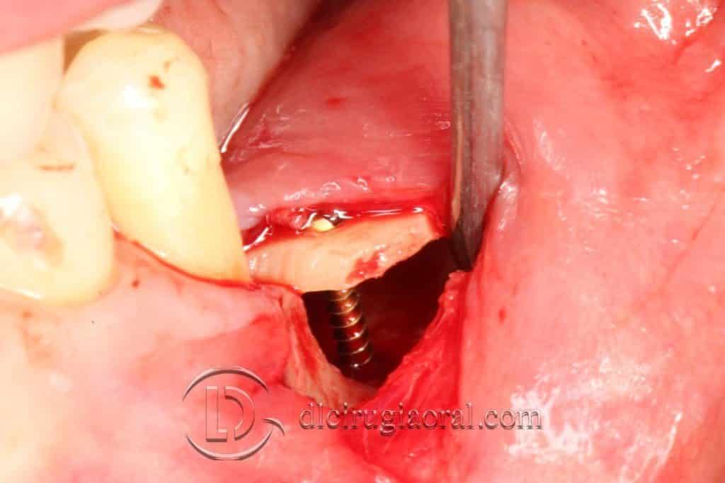 Oral Reconstructive Surgery 46
