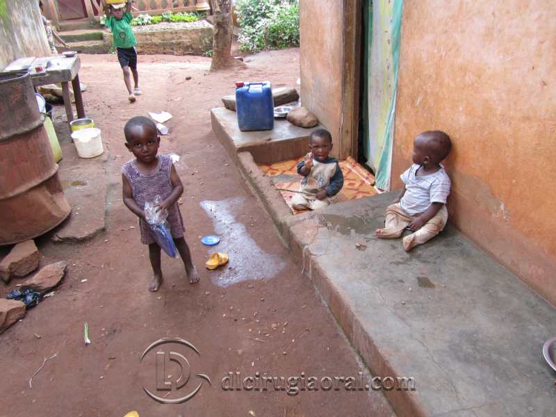 voluntariado odontológico en Camerún