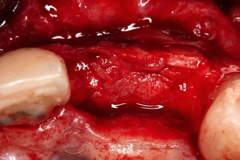 Aspecto oclusal