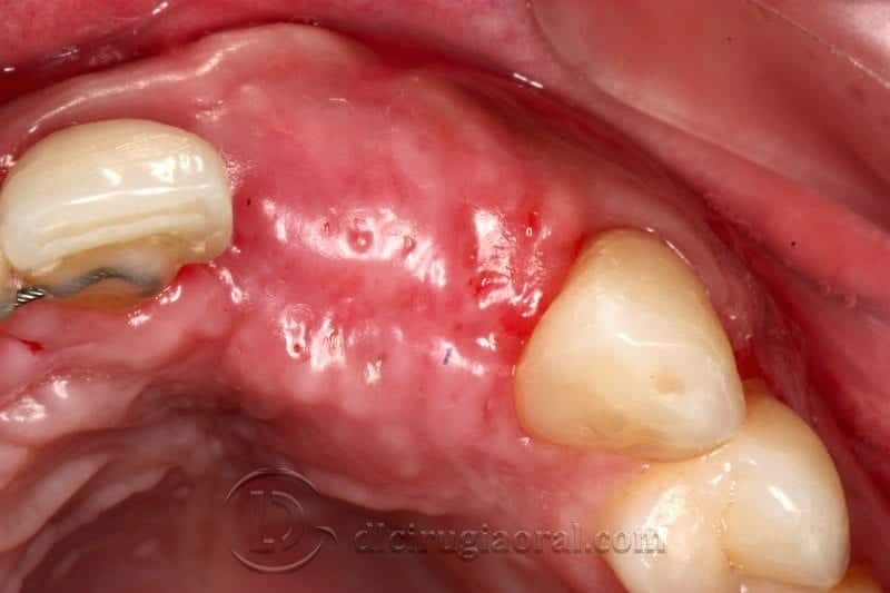 Vista oclusal