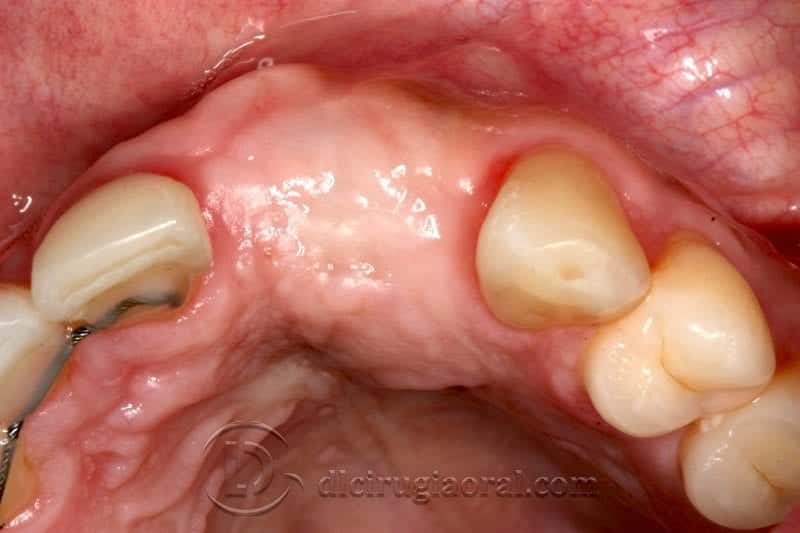 Vista oclusal