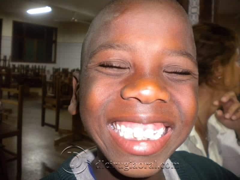 Voluntariado odontológico Mozambique 2009