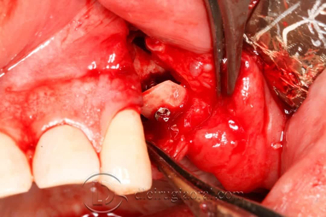curso de cirugía oral