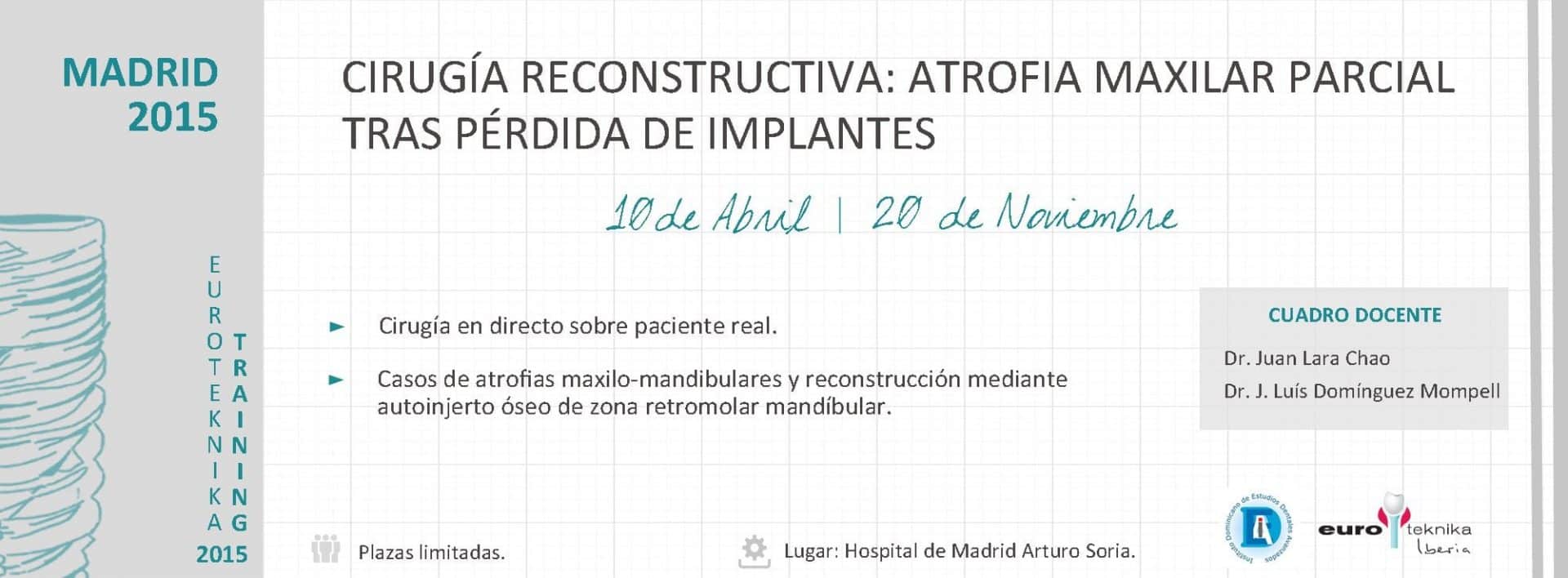 cirugía reconstructiva por atrofia maxilar parcial