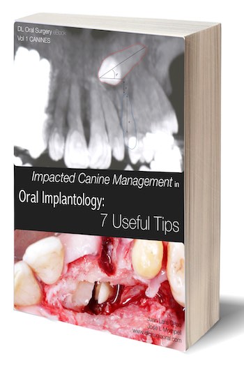 eBook Manejo del Canino Incluido en Implantología